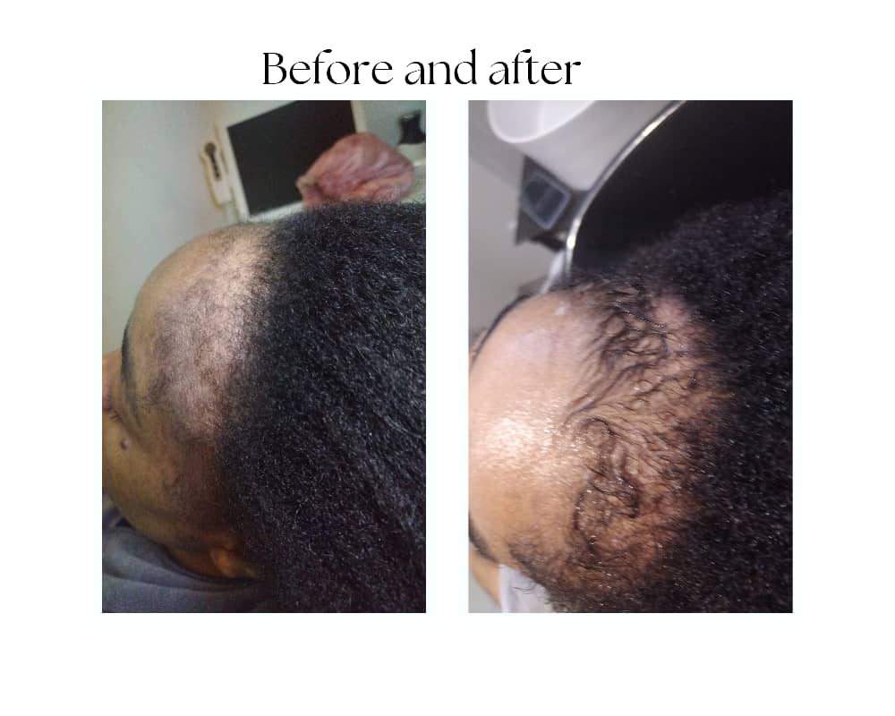 Trichologist performing scalp analysis at Afrilicious Windhoek clinic