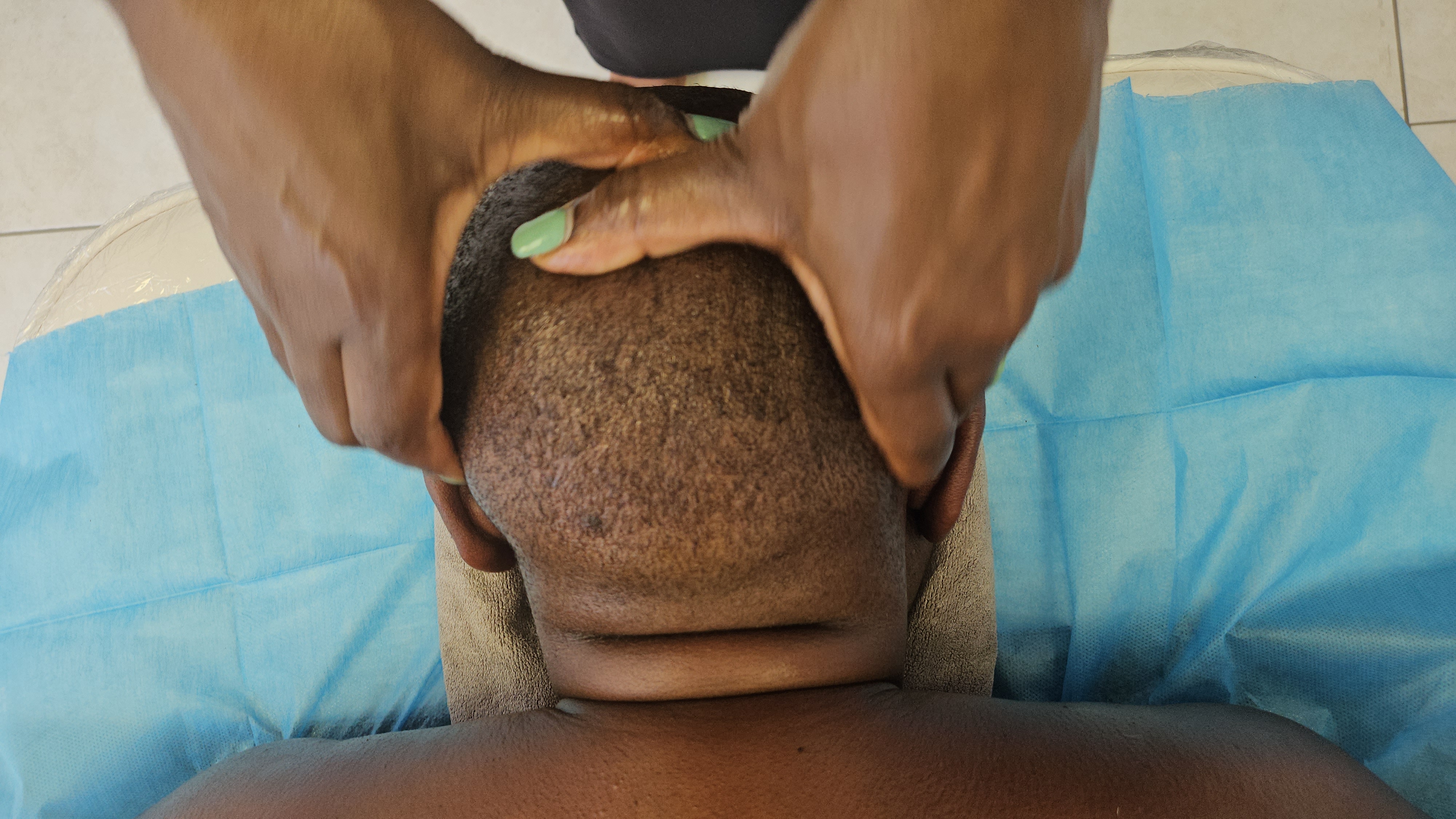 Cupping therapy session for athlete recovery in Swakopmund