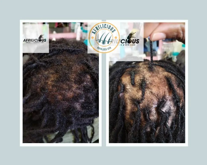Before and after hair growth results at Afrilicious